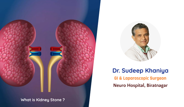 What is Kidney Stone ?